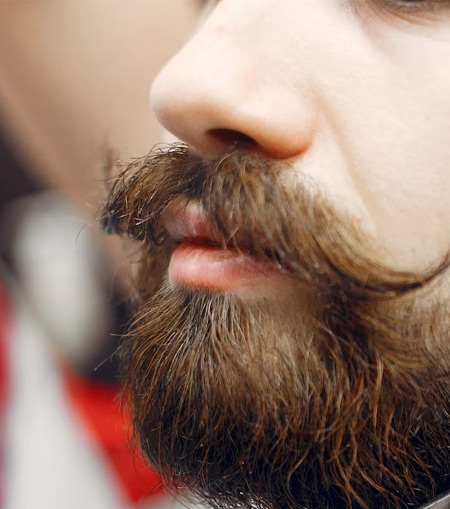 Beard and mustache transplant